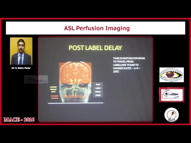 Tralier ASL Perfusion Imaging