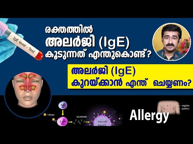 രക്തത്തിൽ അലർജി (IgE) കൂടുന്നത് എന്തുകൊണ്ട് ?അലർജി (IgE) കുറയ്ക്കാൻ എന്ത് ചെയ്യണം ? Imp. Information