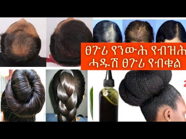 ኣብ ገዛ ብቀሊሉ ዝዘጋጆ መንውሒ መብዝሒ መብቇሊ ፀጉሪ ዘይት /home made hair growth oil /#tigray #ethiopia #habesha