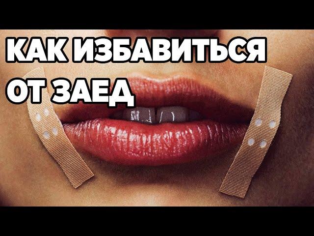 ЛЕЧЕНИЕ ЗАЕДЫ ТРЕЩИНКИ В УГОЛКАХ РТА В КАЖДОЙ АПТЕКЕ ПРОСТОЕ СРЕДСТВО@obovsemsmarusya