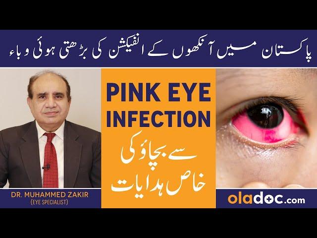 PINK EYE INFECTION IN PAKISTAN - Conjunctivitis Hone Se Kaise Bache- Eye Infection Treatment In Urdu