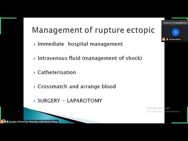 ECTOPIC PREGNANCY - BY Dr. Farhat Banu