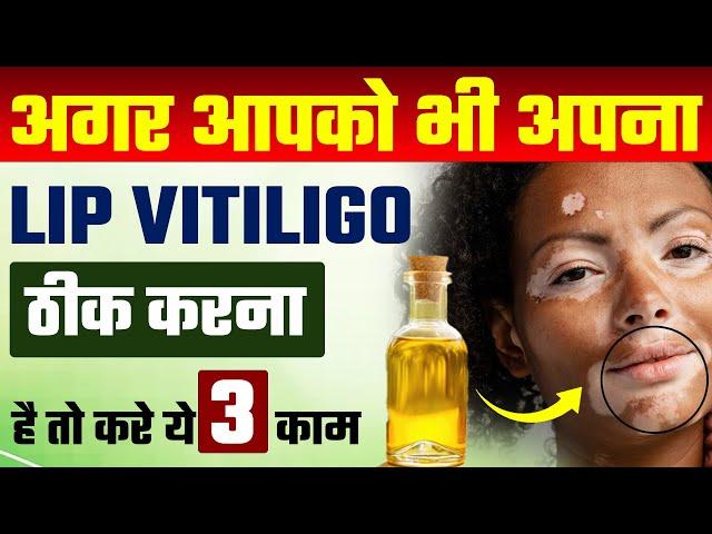 होठ के सफेद दाग का कारण | White spots on lips treatment | होंठ के सफेद दाग कैसे मिटाएं