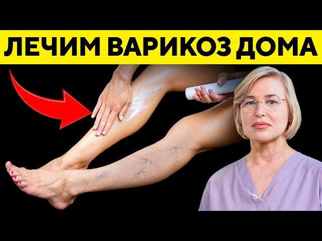 How to treat varicose veins? What should not be done? 2 exercises to restore valves