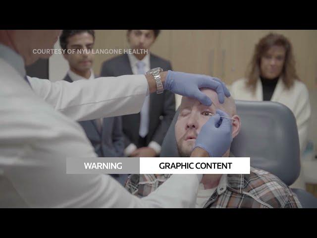 WARNING: GRAPHIC CONTENT- Surgeons perform world's first eye transplant