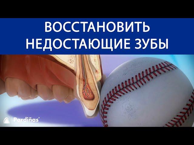 Восстановить недостающие зубы - Save a tooth ©