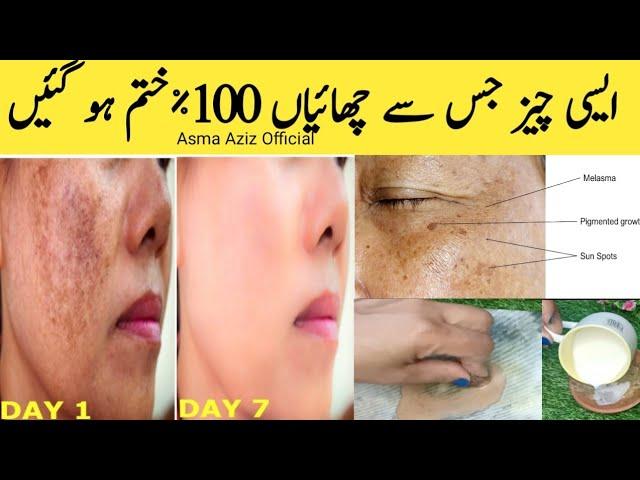 how to remove dark spots from face | dark spots on face removal | jaifal ke fayde for skin