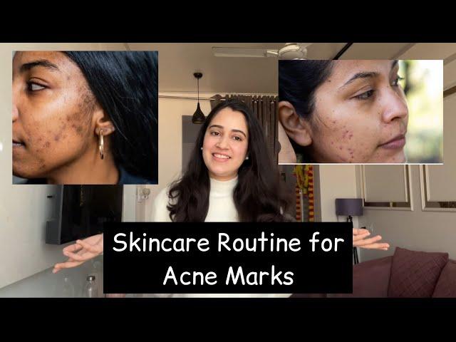 Skincare Routine for acne marks | Acne marks removal routine under rs 500 | skincare | pimple marks