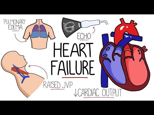 Heart Failure Explained - HFrEF vs HFpEF (Systolic vs Diastolic Heart Failure)