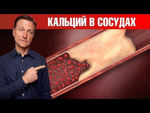 Главная причина кальцификации сосудов‼️ Кальций в сосудах