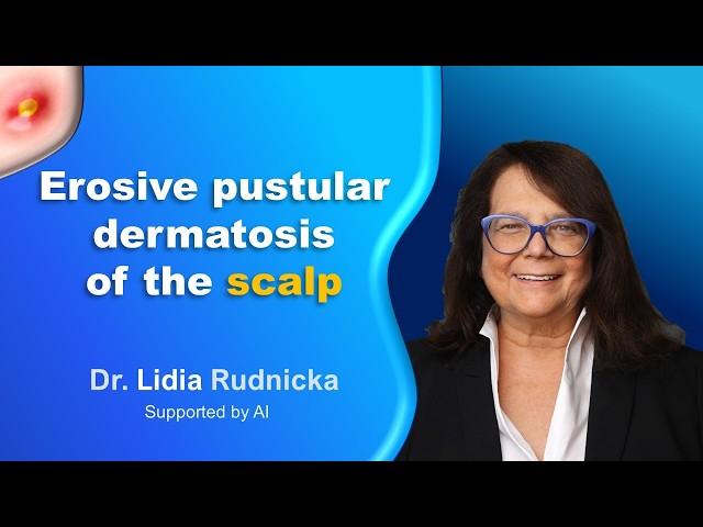 Erosive pustular dermatosis of the scalp - a cicatricial alopecia (2-minute review)