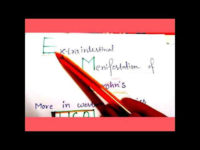 Extraintestinal Menifestation of Crohn's(IBD) disease Mnemonics for NEET-PG, USMLE Step 1 Prep