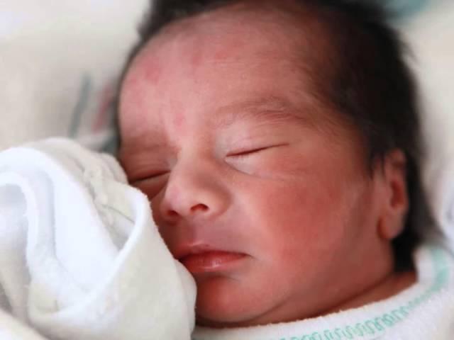 Increasing Breastfeeding Rates in Sonoma County with Evidenced-Based Hospital Efforts