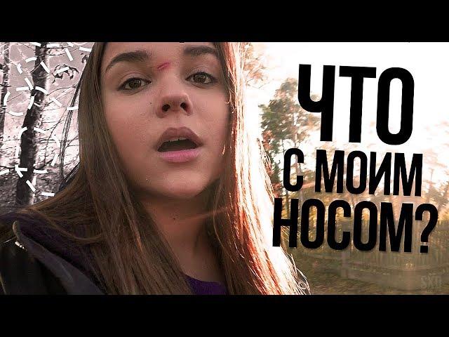 VLOG:ЧТО С МОИМ НОСОМ? живём с подругой одни в другой стране/Латвия