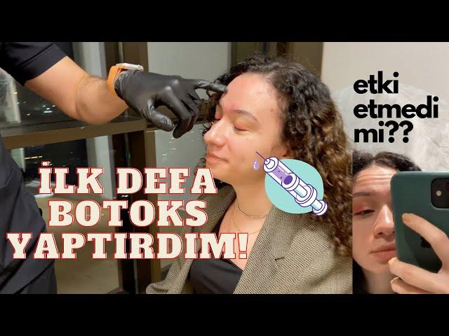 İLK DEFA BOTOKS YAPTIRDIM! | YAN ETKİLERİ? Natürel Botoksun Tüm Süreci