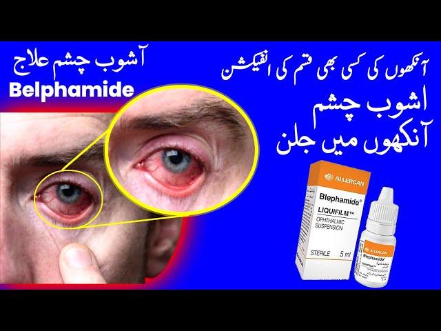 blephamide eye drop ️ || uses || side effects || opthalmology