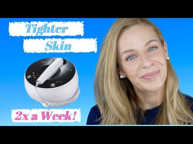 Skin Tightening | At Home Radio Frequency Device | Mlay | Mature Beauty | No Botox