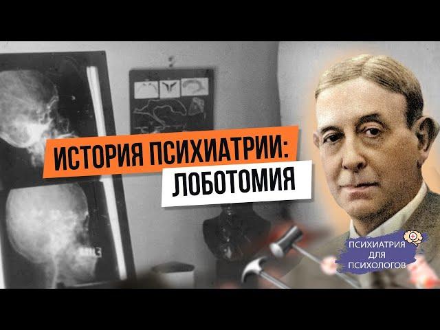 История психиатрии. Лоботомия