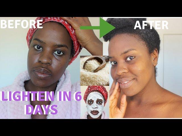 How I How i BRIGHTENED MY SKIN IN 6 DAYS| REALISTIC and Natural way to reduce hyperpigmentation