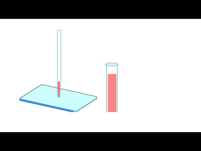 A Human Karyotype Preparation Animation