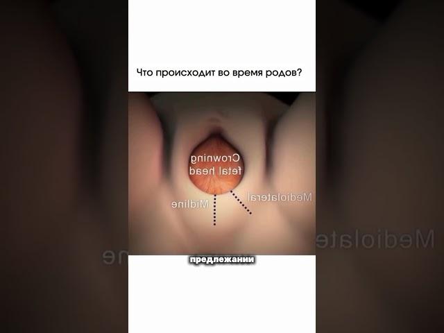 Что происходит во время родов? #акушергинеколог #акушерство #доктор #роды #беременность #матка