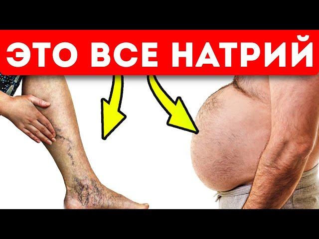 10 признаков того, что в вашем организме слишком много натрия (расскажем, как вывести)