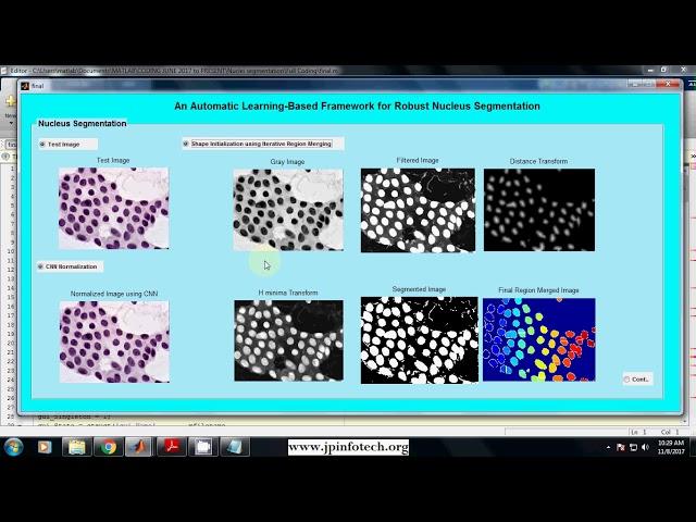 An Automatic Learning-Based Framework for Robust Nucleus Segmentation | Matlab IEEE Project