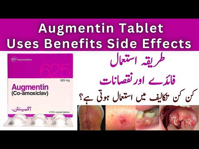 How To Use Augmentin 625mg Tablets Used For In Urdu | Side Effects