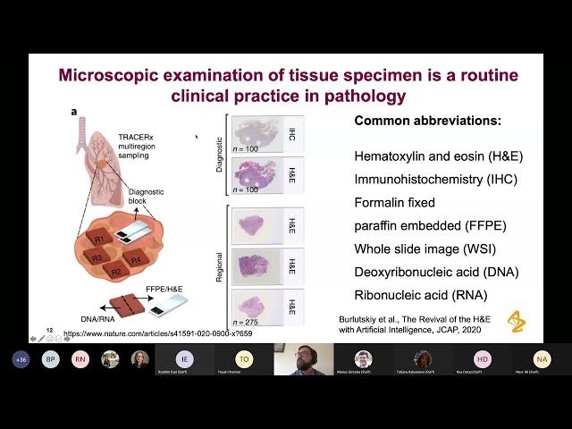 Artificial Intelligence in Oncology by Dr Nikolay Burlutskiy   Astrazeneca