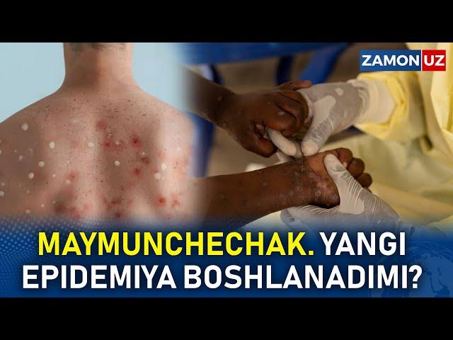 MAYMUNCHECHAK. YANGI EPIDEMIYA BOSHLANADIMI?