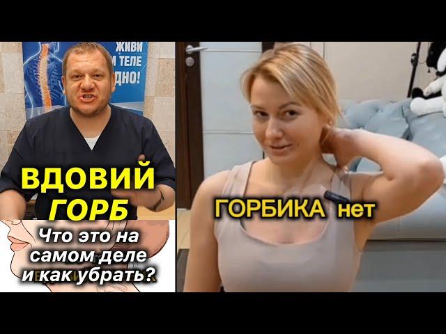 Вдовий Горб️Что Это На Самом Деле? Как убрать холку #холка #вдовийгорб