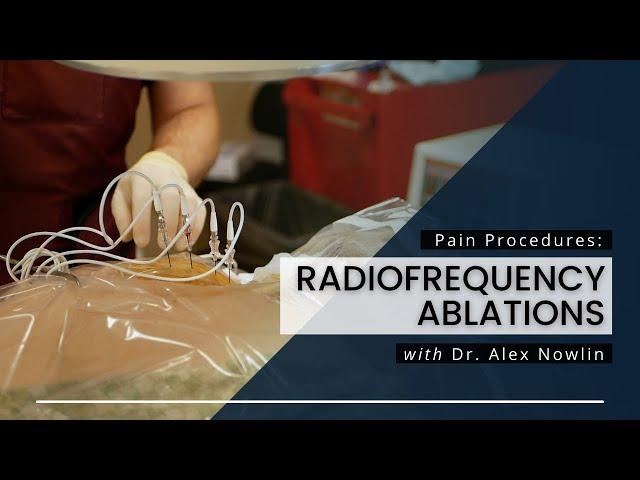 Radiofrequency Ablations: What You Should Know