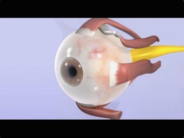 Keen Medical Animations & Illustrations