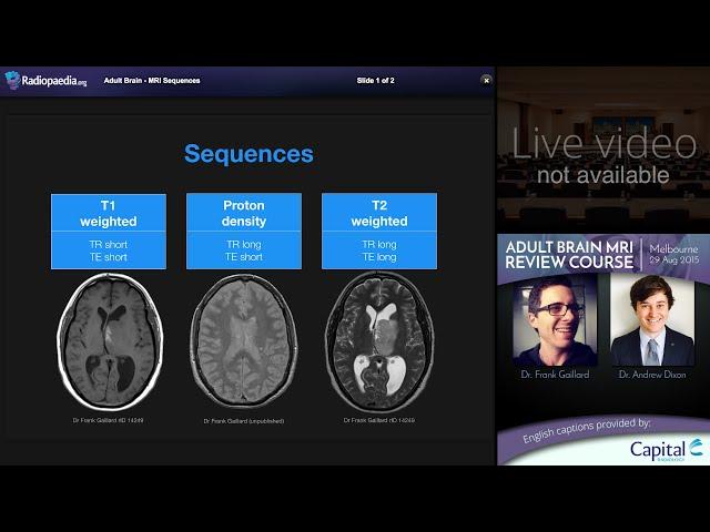 MRI Brain Sequences - radiology video tutorial