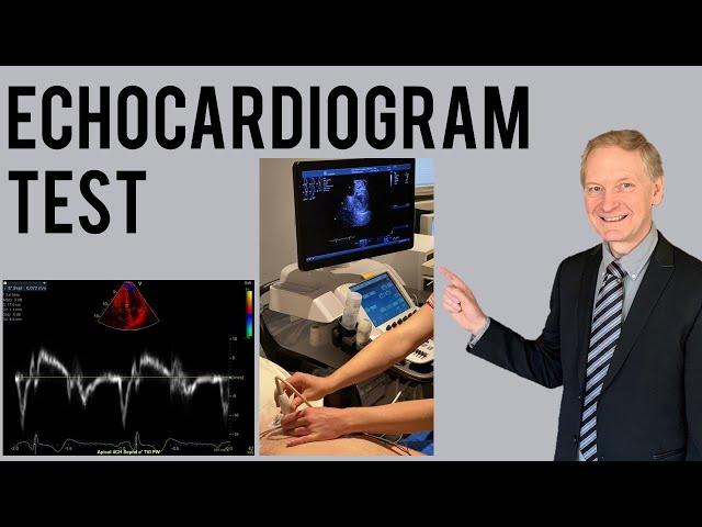 Echocardiogram Procedure | Heart Ultrasound | Everything you need to know