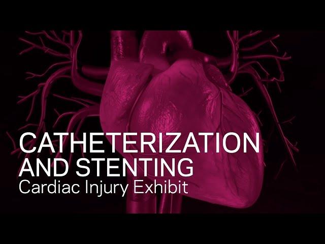 Cardiac Catheterization and Stenting