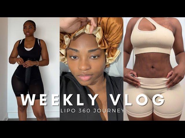 LIPO 360 RECOVERY | SHE GAVE ME FIBROSIS! + Feeling Discouraged + Stage Two Faja Try-On