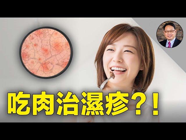 揭秘造成濕疹的5大元兇！採用這種饮食方式，不吃藥就可讓濕疹消失！