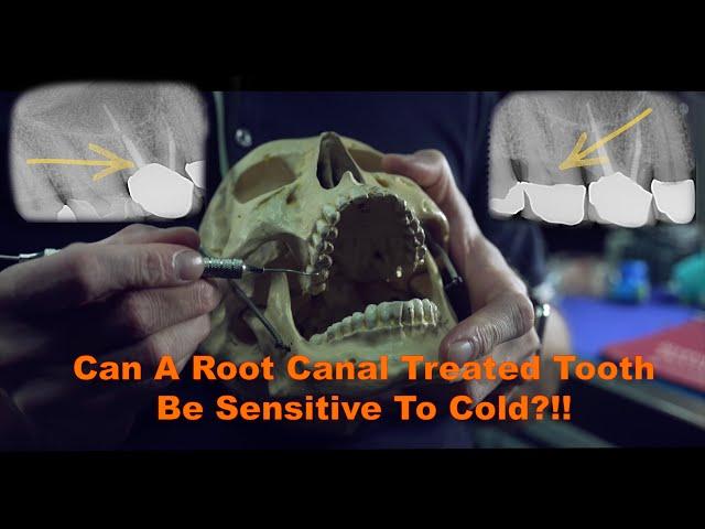 Can a root canal treated tooth be sensitive to cold?