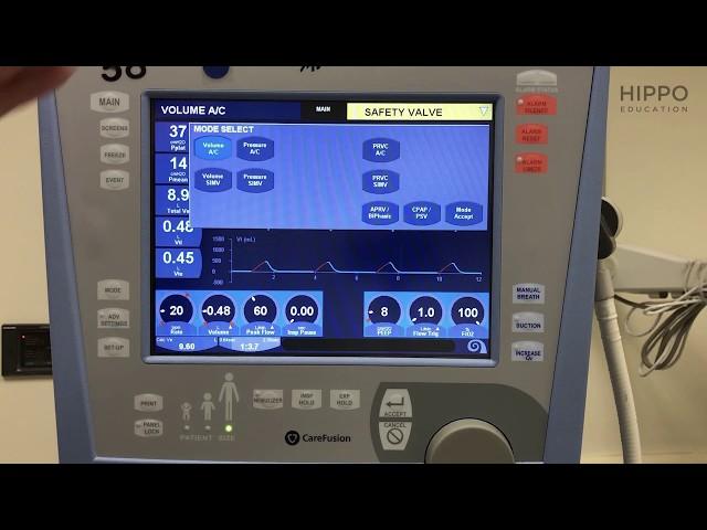 Basic Ventilator Knobology and COVID Settings