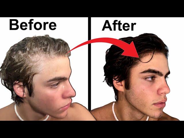 How To Stop Balding | Full hair loss guide