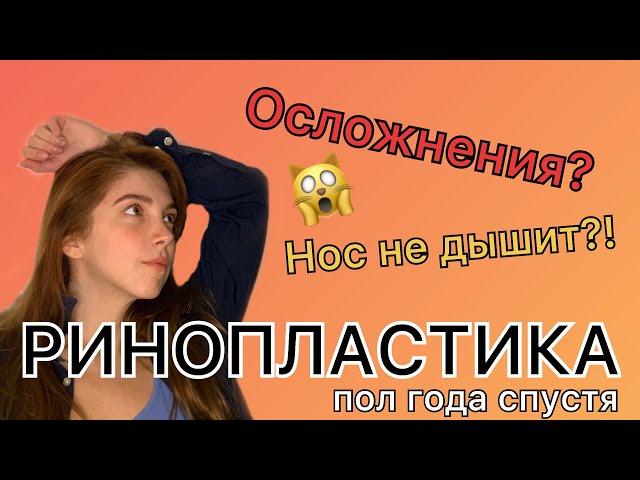 РИНОПЛАСТИКА. ПОЛ ГОДА ПОСЛЕ ОПЕРАЦИИ