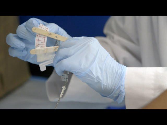Stanford fellows design medical device made of popsicle sticks