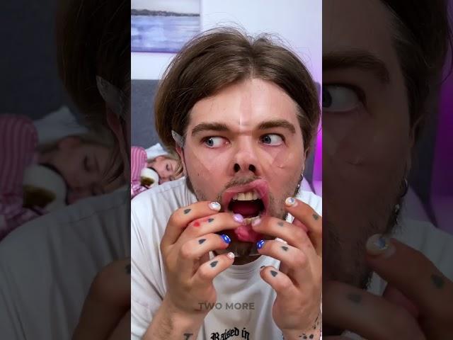 POPPED OUT EYES PRANK 