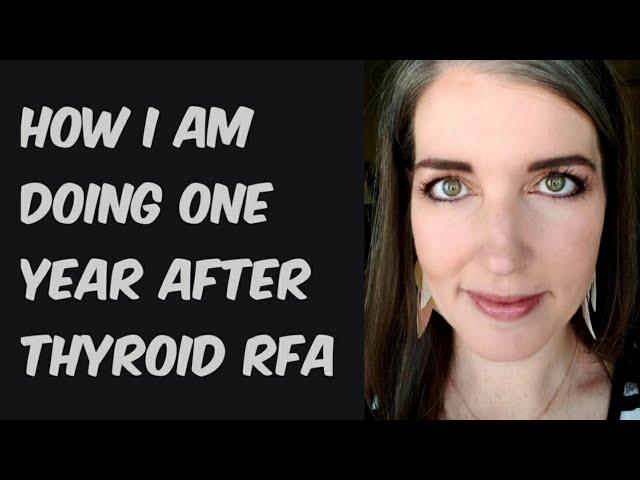 Thyroid RFA: One year later