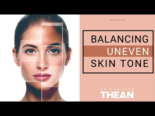 What Causes Uneven Skin Tone & How to Treat it Naturally?