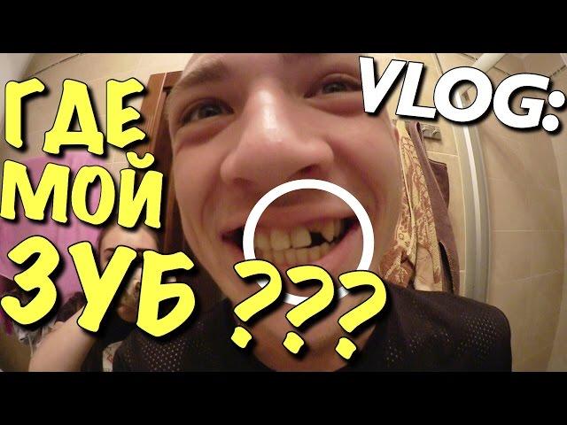 VLOG: ГДЕ МОЙ ЗУБ ??? / Андрей Мартыненко