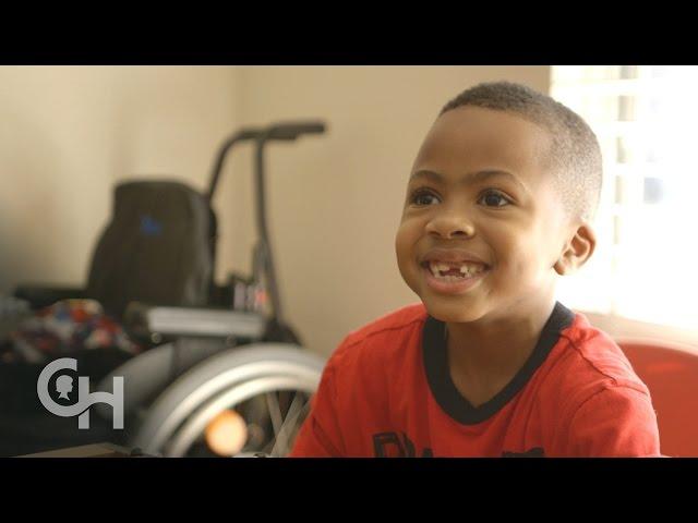 First Bilateral Hand Transplant in a Child: Zion's Story