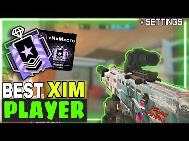 Im The BEST Console PLAYER - Anifex? ( Best of DXNI ) - Rainbow Six Siege