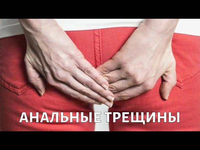 Как лечить АНАЛЬНЫЕ трещины?